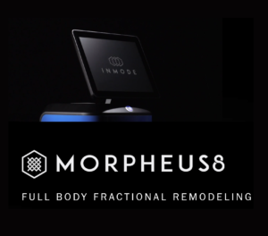 morpheus8-behandlung-inmode